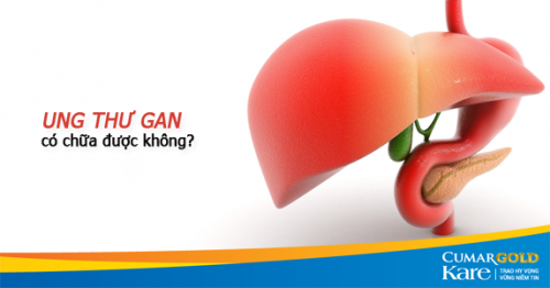 Ung thư gan có chữa được không?